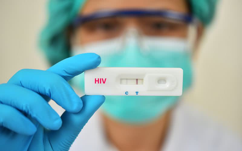 Segundo a UNAIDS, cerca de 38 milhões de pessoas no mundo vivem com HIV - iStock