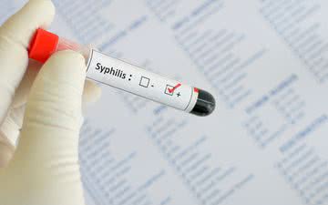 Veja como é feito o tratamento de sífilis - iStock