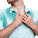 Estima-se que cerca de 1% a 3% dos brasileiros sofrem com o suor excessivo - iStock