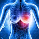 Pesquisa tenta identificar as causas evitáveis do câncer de mama e quais produtos químicos poderiam aumentar o risco de desenvolver a doença - iStock