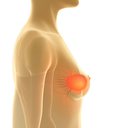 Durante a pesquisa com a nova droga, em camundongos com câncer, a doença diminuiu em mais de 99% em apenas três dias - iStock