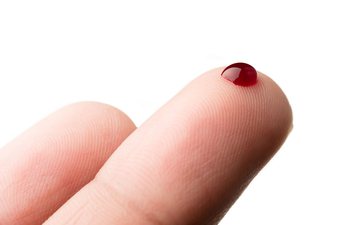 Uma inflamação, um quadro de infecção, um machucado, tudo isso pode ter acontecido - iStock