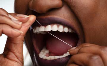 O uso do fio dental todos os dias é imprescindível para uma boa saúde bucal - iStock