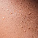 Animais secretaram sebo rico em gordura e calorias das glândulas sebáceas da pele; estudo precisa ser feito em humanos - iStock