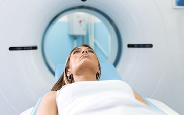 O câncer do pulmão de células não pequenas em pessoas que nunca fumaram é observado mais frequentemente em mulheres - iStock