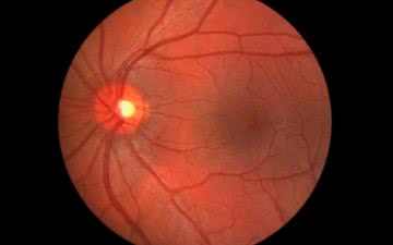A presença dessas partículas virais reforça possíveis manifestações clínicas oculares da infecção - iStock