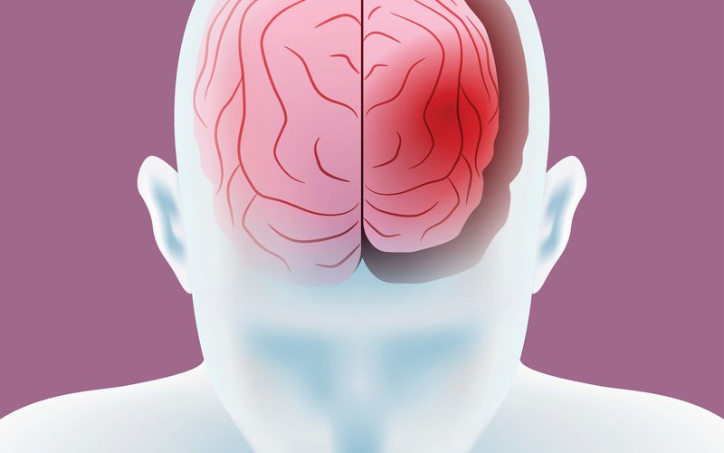 A pesquisa tinha como objetivo compreender como o envelhecimento afeta a geometria de todo o cérebro - iStock