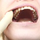 Além do amarelamento, cigarros podem causar cárie, periodontite e a perda de dentes, o que abala a autoestima - iStock