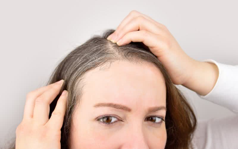 É quando os cabelos estão sob a pele, como folículos, que eles estão sujeitos à influência de hormônios do estresse - iStock