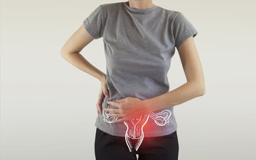 Existem diferentes tipos de câncer ginecológico - iStock