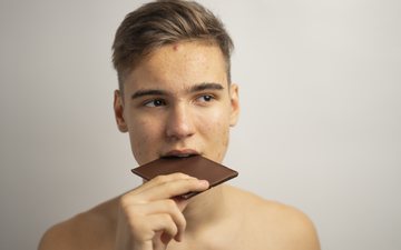 A origem da acne tem a ver com alterações hormonais - iStock
