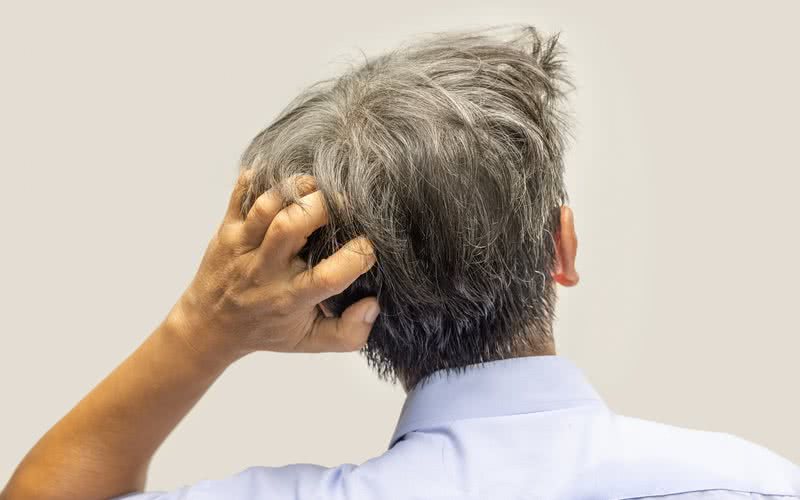 Problemas no couro cabeludo podem afetar a qualidade de vida e a autoestima - iStock