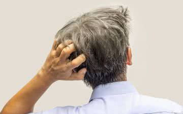 Problemas no couro cabeludo podem afetar a qualidade de vida e a autoestima - iStock