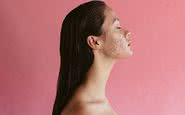 Atualmente, 40% das mulheres adultas acima de 25 anos tem acne, uma proporção que aumentou muito - iStock