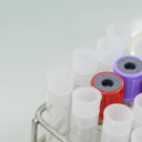 Níveis elevados de açúcar no sangue e triglicerídeos foram associados a risco mais alto de transtorno mental - iStock