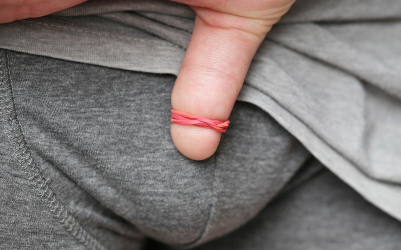 Fimose é o estreitamento da pele que recobre a cabeça do pênis - iStock