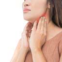 Gânglios inchados podem indicar algum tipo de infecção - iStock