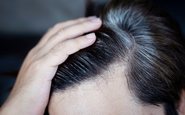O surgimento dos fios brancos é um processo gradual e, quase sempre, determinado pela genética - iStock
