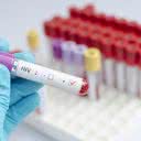 Segundo a Unaids, cerca de 38 milhões de pessoas em todo o mundo vivem com o HIV