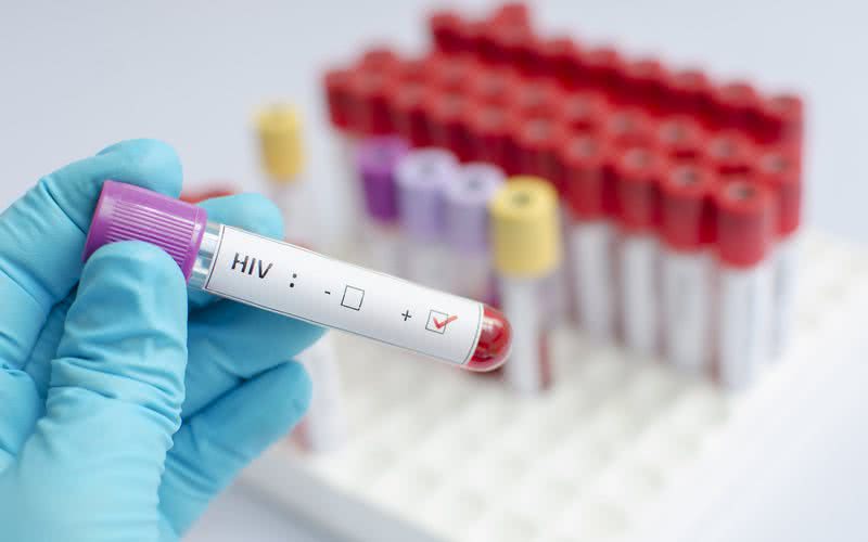 Segundo a Unaids, cerca de 38 milhões de pessoas em todo o mundo vivem com o HIV
