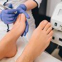 O laser de baixa intensidade tem sido usado para casos mais resistentes ou de repetição - iStock