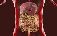 Se o microbioma intestinal fica desequilibrado e contém mais bactérias ruins do que boas, o sistema imunológico pode ser acionado - iStock