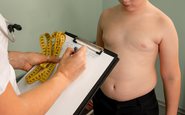 A prevalência de excesso de peso para a faixa etária de 5 a 10 anos aumentou 3,2% entre meninos - iStock