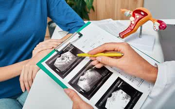 Reserva ovariana é o estoque de óvulos que a mulher tem até chegar na menopausa - iStock