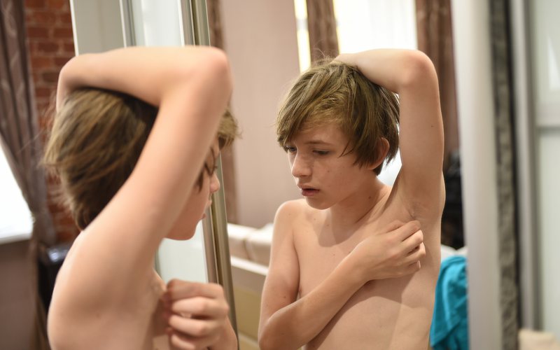 Garoto está preocupado pela ausência de pelos nas axilas e na região pubiana - iStock