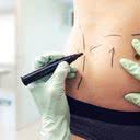 Todo paciente que vai ao consultório de cirurgia plástica chega com um resultado pronto no pensamento - iStock