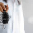 Nas fases iniciais desse tipo de alopecia, a situação ainda é reversível - iStock