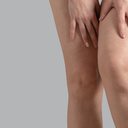 Entre as principais causas da retenção de líquido estão mudanças hormonais e falta de exercício físico - iStock