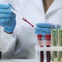 Os testes de quarta geração para detectar o HIV são mais potentes - iStock