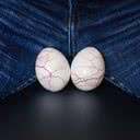 Varicocele são pequenas varizes que alguns homens podem ter nos testículos - iStock