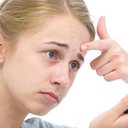 A acne é uma condição prevalente na adolescência capaz de afetar também o psicológico - iStock